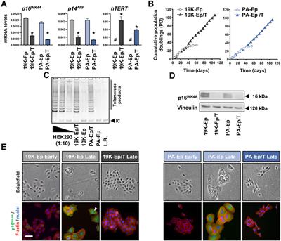 Immortalization of patient-derived lip cells for establishing 3D lip models